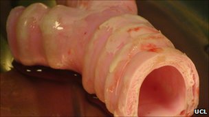 _53902589_cellularisedscaffoldforpatient.jpg